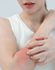 Sensitive skin protection